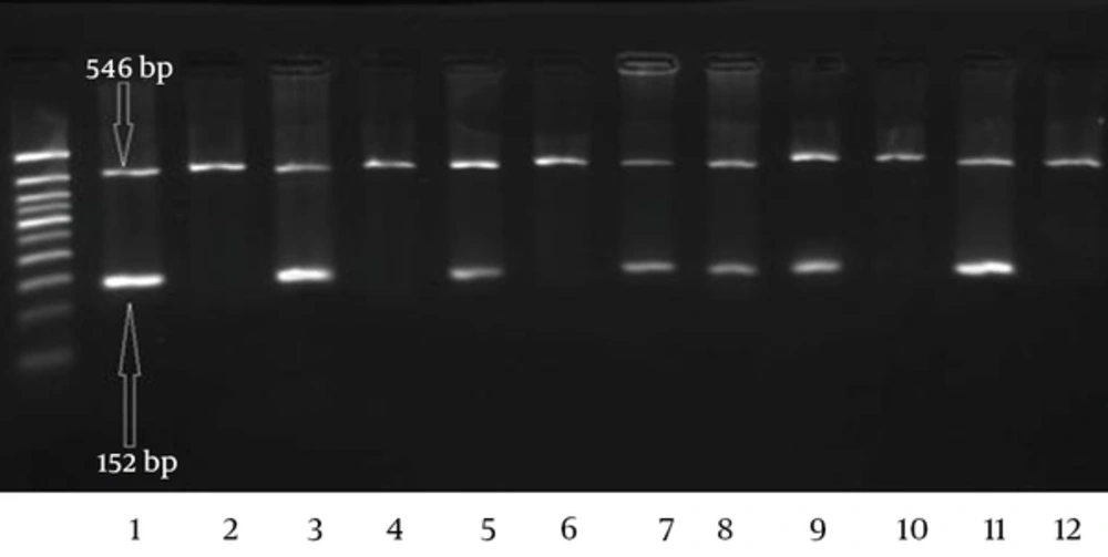 Agarose gel electrophoresis of the amplification products of FV Leiden mutation in F5 gene by ARMS-PCR. The first of each two well belongs to the normal primer for Arg allele (G allele), and the second is for the mutant allele Gln (A allele). Wells 1/2, 3/4, 5/6, 9/10 and 11/12 show the GG (Arg/Arg) genotype. Wells 7/8 related to heterozygote genotype. The 50 bp size marker is loaded in the first well. Agarose gel electrophoresis of the amplification products of FV Leiden mutation in F5 gene by ARMS-PCR. The first of each two well belongs to the normal primer for Arg allele (G allele), and the second is for the mutant allele Gln (A allele). Wells 1/2, 3/4, 5/6, 9/10 and 11/12 show the GG (Arg/Arg) genotype. Wells 7/8 related to heterozygote genotype. The 50 bp size marker is loaded in the first well.