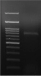 Detection of Metallo-Beta-Lactamase-Encoding Genes Among Clinical Isolates of Pseudomonas aeruginosa in Qom Province