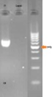 The First Report of GAC>AAC Mutation in Familial Hypercholesterolemia in Khuzestan