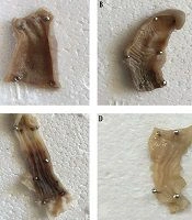 The Effect of Mesenchymal Stem Cells Pulsed with 17 Beta-Estradiol in an Ameliorating Rat Model of Ulcerative Colitis