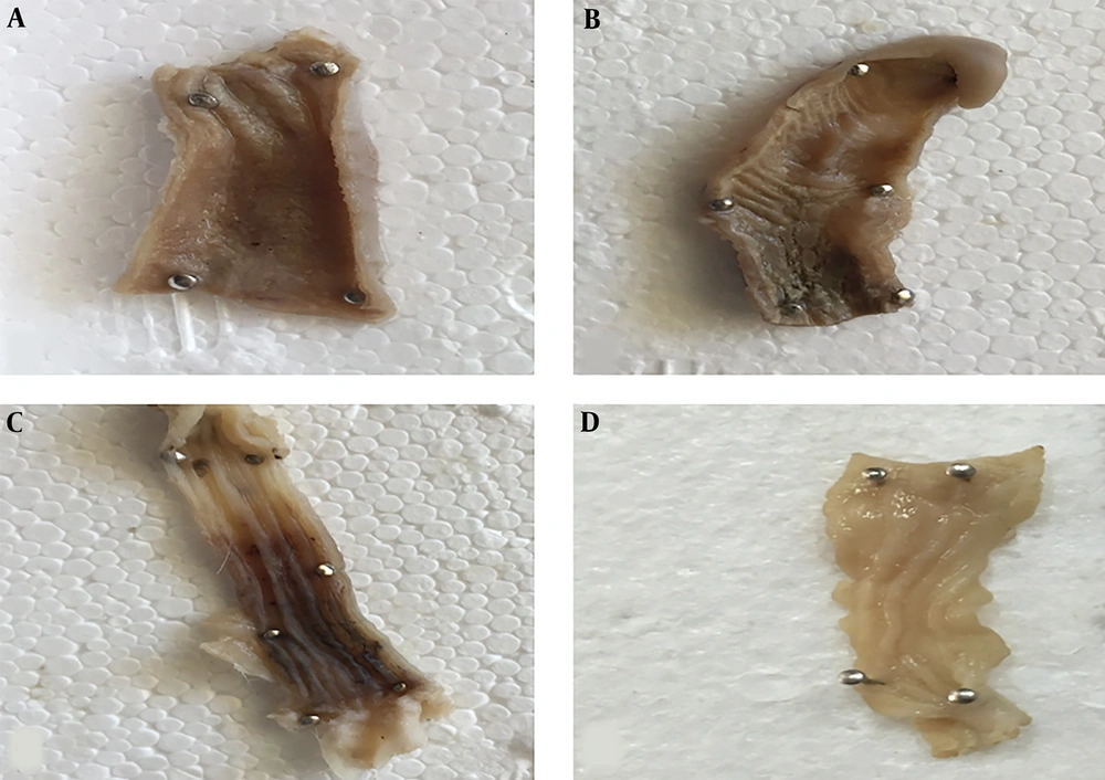 Gross pathology of the colonic mucosa in experimental groups. A, Representative fields depicted the appearance of the colonic mucosa in E2-MSCs-treated rat; B, MSCs-treated rat; C, control rat with colitis; and D, the normal rat. Gross pathology of the colonic mucosa in experimental groups. A, Representative fields depicted the appearance of the colonic mucosa in E2-MSCs-treated rat; B, MSCs-treated rat; C, control rat with colitis; and D, the normal rat.