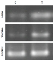 Cover image of the article: Exercise Training Enhances Expression of Tropomedulin-2 and ADP-Ribosylation Factor 6 in the Cerebellum of Male Wistar Rats